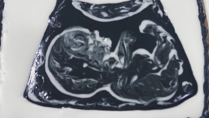 Image for Frosted Ultrasound Photo